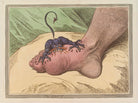 'The gout' NPG D12692